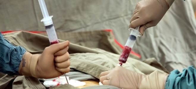 Стволовые клетки помогут снова ходить