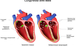 Сердце будет в порядке