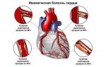 Пища, способствующая воспалению, увеличивает риск болезней сердца и инсульта