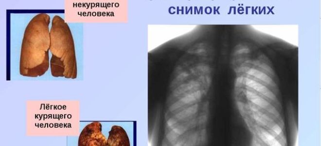 Всемирный день без табака.