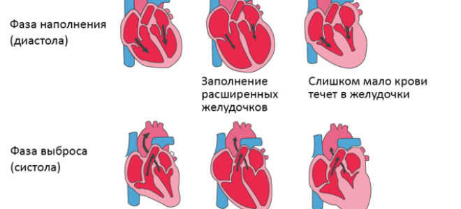 Избыток соли приводит к сердечным недугам