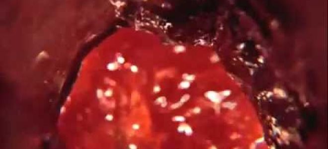 Чем вреден алкоголь для организма человека?