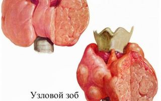 10 признаков проблем с щитовидной железой