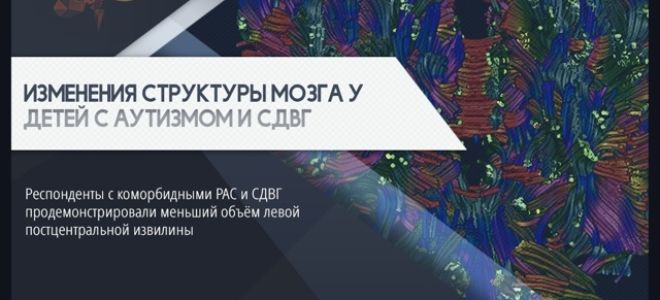 Анемия на ранних сроках беременности повышает риск возникновения у младенца аутизма, СДВГ и нарушения интеллекта