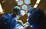 Минздрав рассмотрит петицию о введении донорства органов не только от генетических родственников