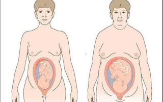 Диабет во время беременности несет риски болезней сердца для повзрослевших детей