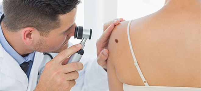 Любители загара смерти не боятся