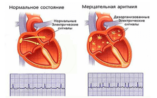 Удар прямо в сердце