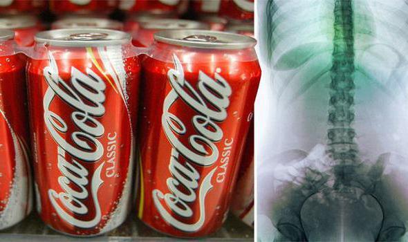 Вред и влияние Кока-колы на организм человека