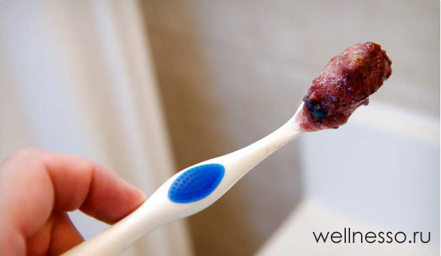 Чистка зубов содой — польза и вред