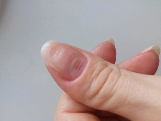 Чем может быть вреден шеллак для ногтей