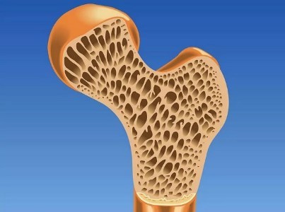 Чернослив защищает от остеопороза