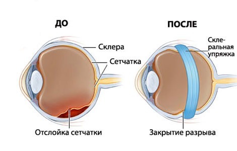 От гаджетов страдает сетчатка глаза