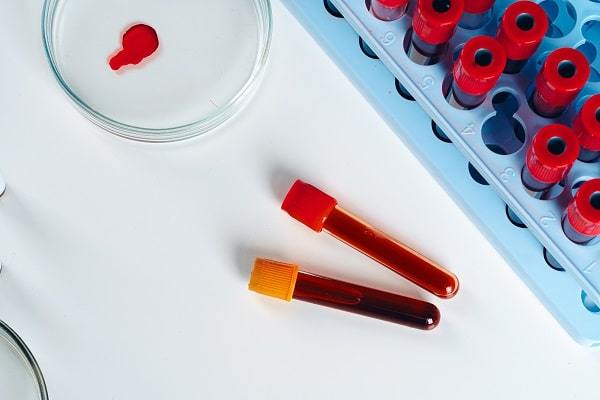 Биохимический анализ крови. Ферменты. Часть вторая
