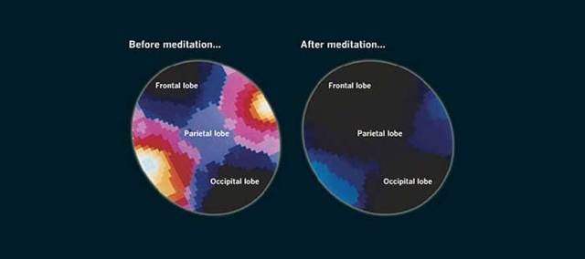 20 минут медитации благотворно влияют на мозг
