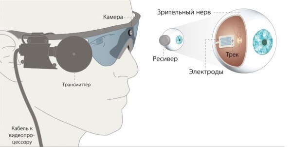 В России проведут операцию по пересадке бионического глаза