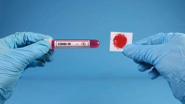 Тест на Т-клетки к COVID-19 может оказаться точнее теста на антитела