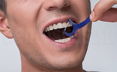 Как сохранить белизну зубов
