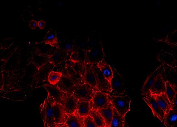 Новый клеточный имплантат заменит поджелудочную железу у диабетиков