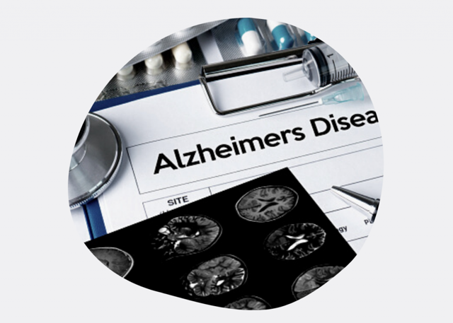 Ослабление обоняния – признак болезни Альцгеймера