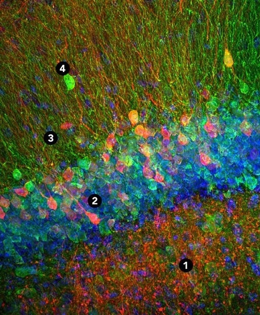 Бег стимулирует появления новых клеток в головном мозге