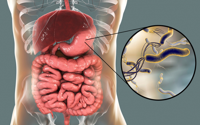 Бактерии ротовой полости вызывают рак кишечника