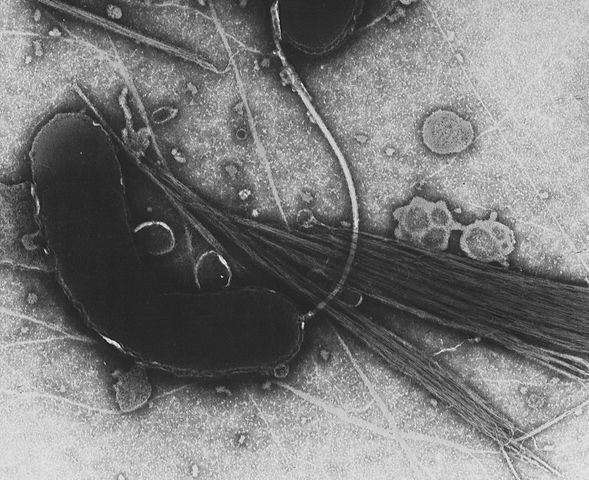 Уникальная вакцина ФМБА против холеры остановит мировые эпидемии