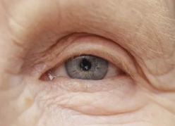Физические нагрузки снижают риск развития глаукомы